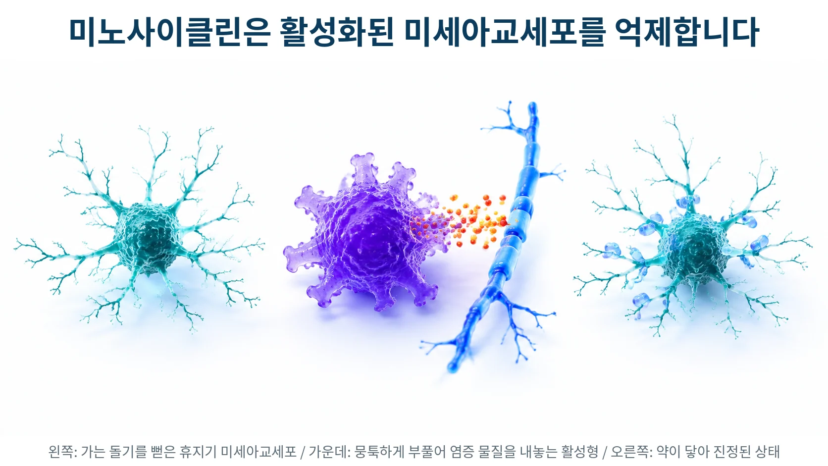 휴지기 미세아교세포와 활성화된 미세아교세포, 그리고 미노사이클린이 활성화를 억제하는 지점을 보여주는 3D 의료 일러스트