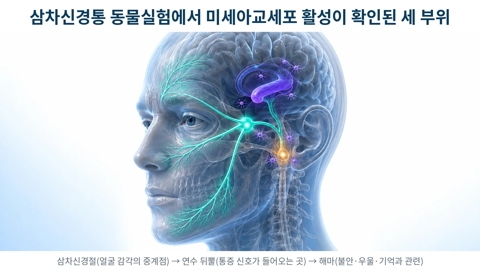삼차신경 경로와 동물실험에서 미세아교세포 활성이 확인된 부위 — 삼차신경절, 연수 뒤뿔, 해마를 표시한 3D 의료 일러스트