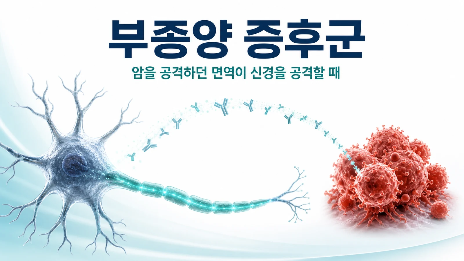 암세포와 신경세포 사이를 항체가 오가는 부종양 증후군 개념도