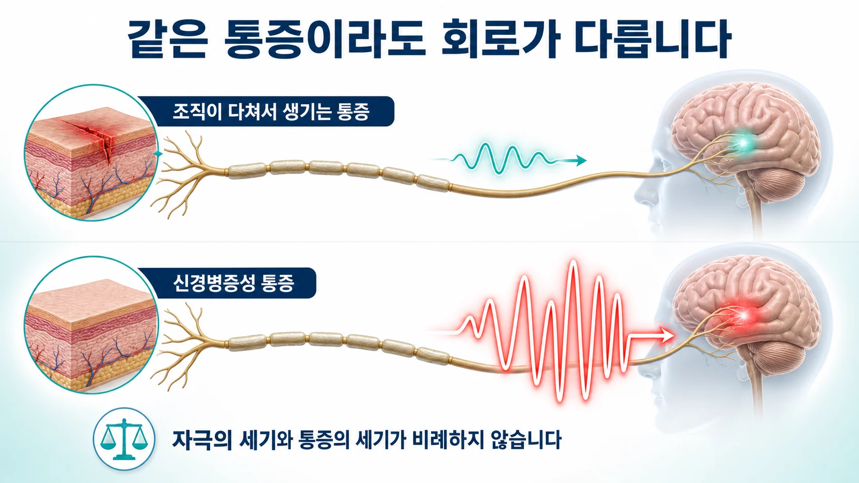 신경병증성 통증을 보는 관점