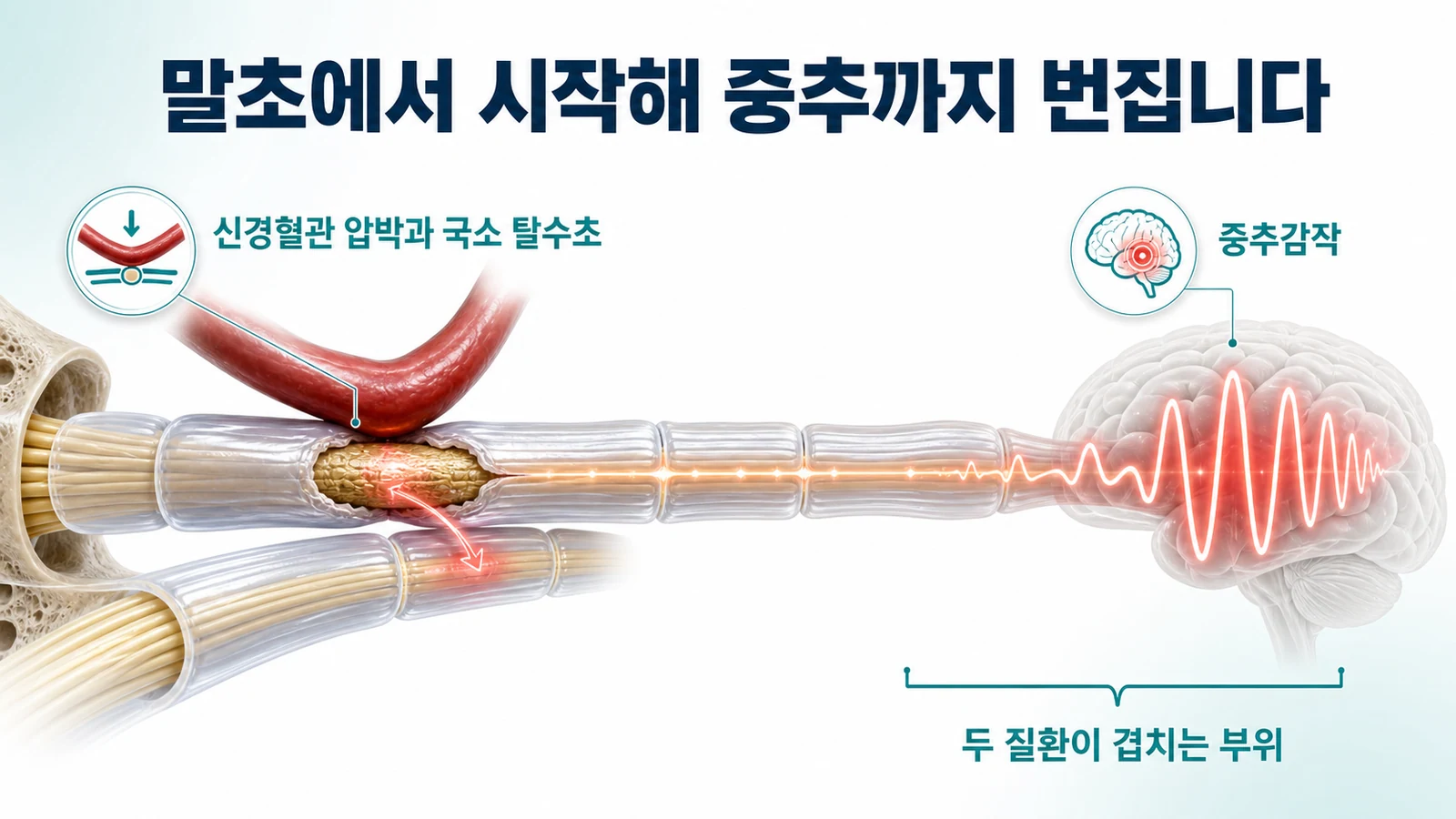 병리 기전의 차이와 겹치는 자리