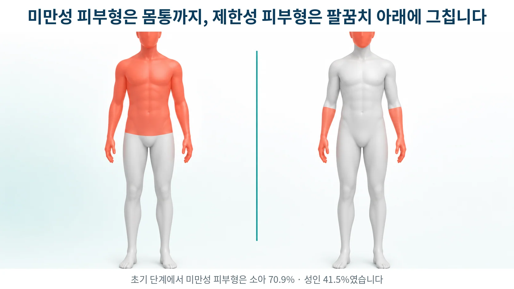 두 개의 인체 실루엣에서 왼쪽은 얼굴과 몸통과 팔 전체가, 오른쪽은 손과 팔꿈치 아래와 얼굴만 붉게 표시된 비교 그림