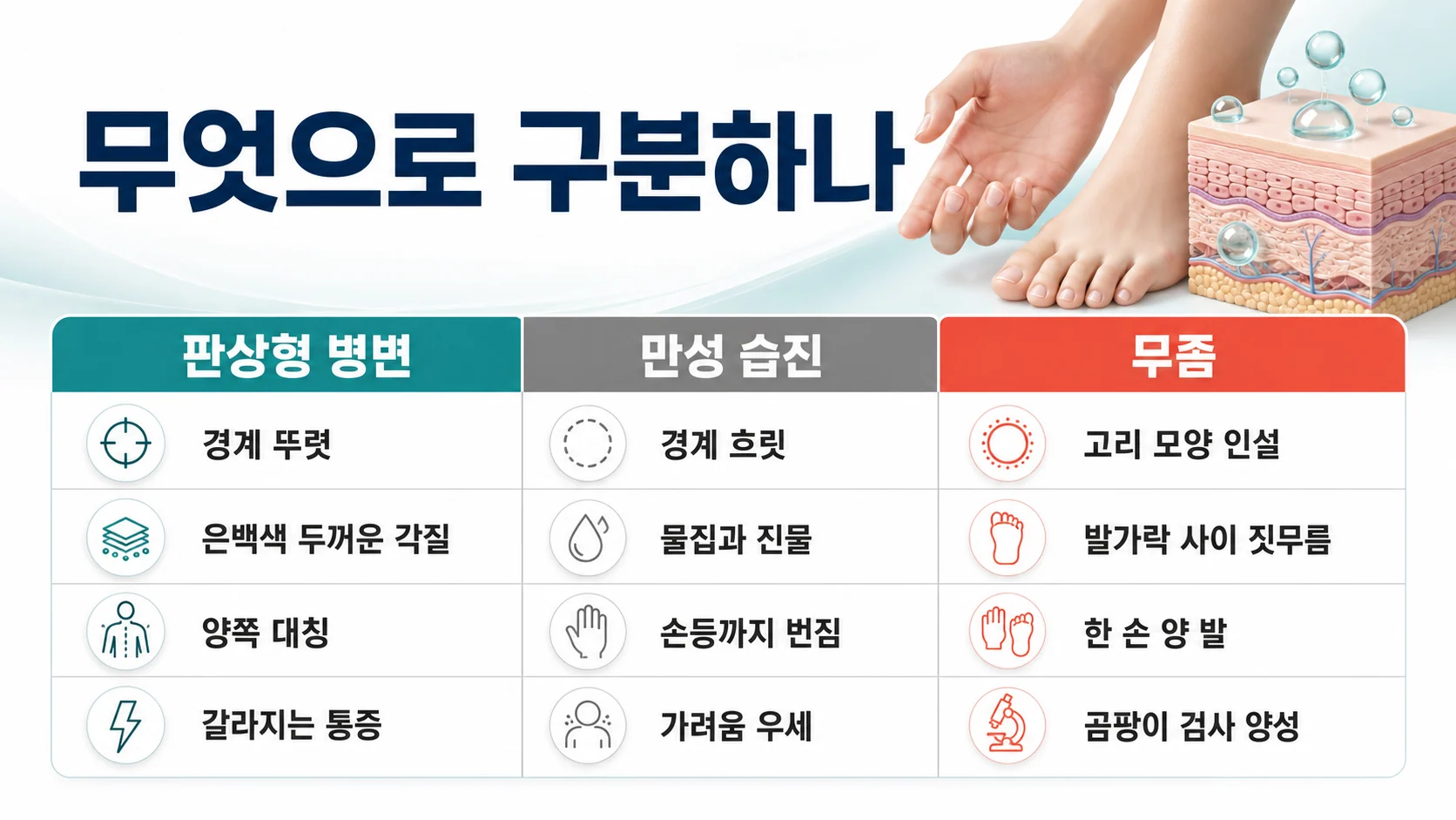손발바닥 판상형 병변과 만성 습진, 무좀의 감별 포인트를 정리한 비교 이미지