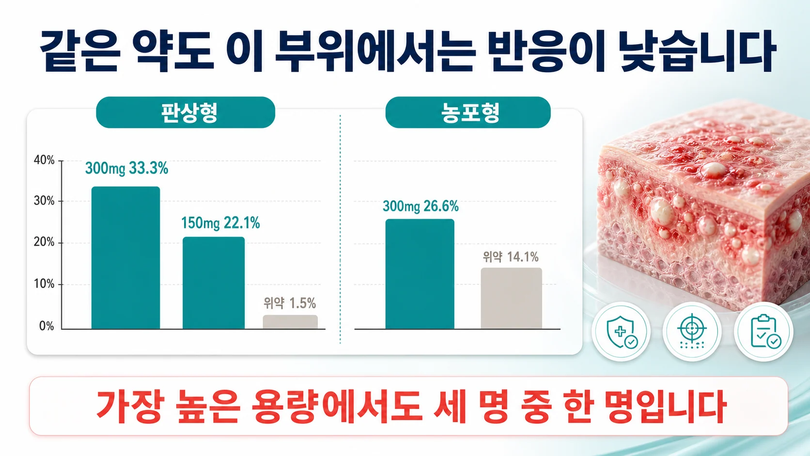 손발바닥 병변의 치료 반응이 다른 부위보다 낮다는 임상시험 결과를 보여 주는 이미지