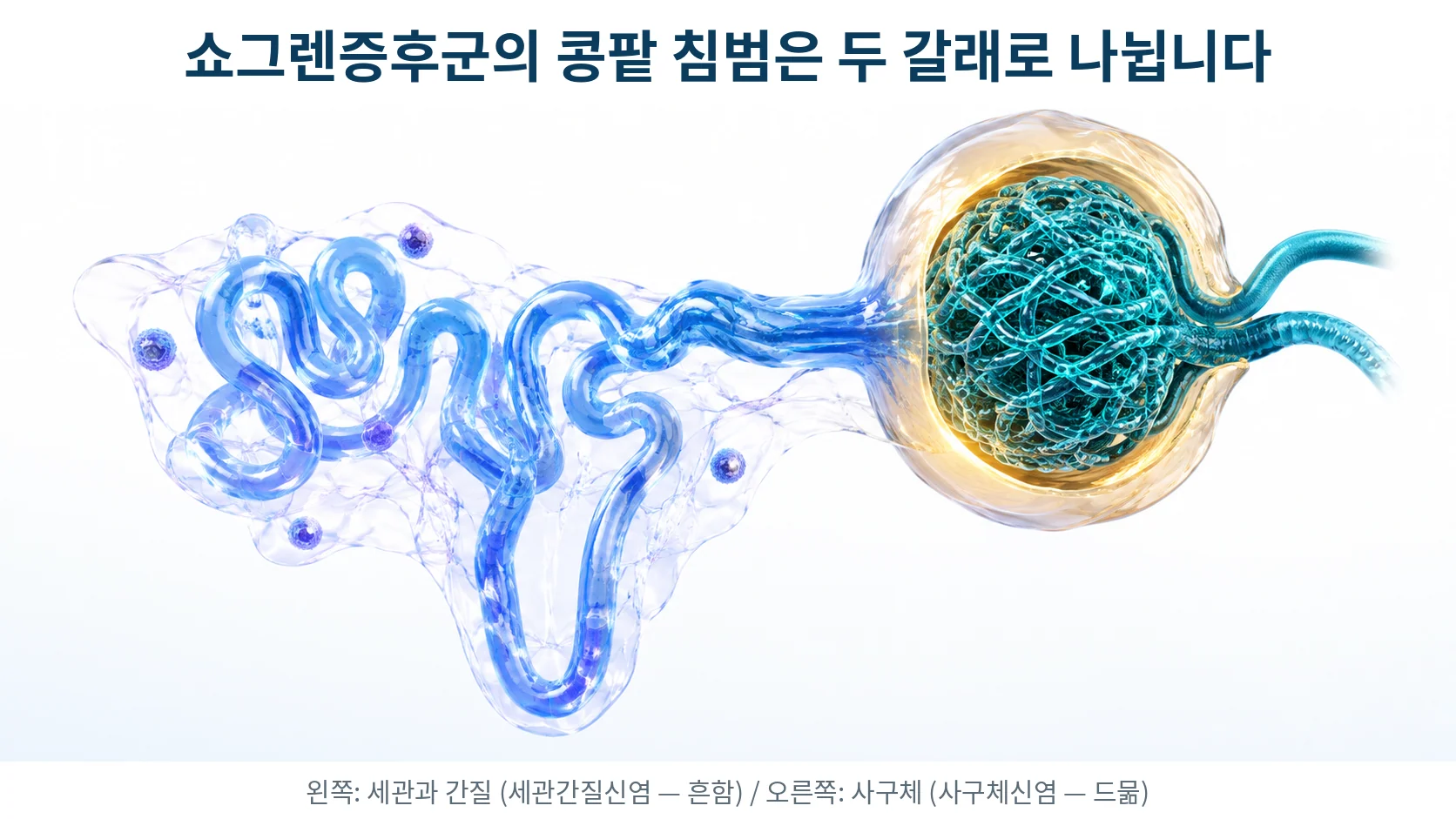 콩팥의 네프론 구조 — 세관과 그 사이 간질, 그리고 사구체를 구분해 보여주는 3D 의료 일러스트