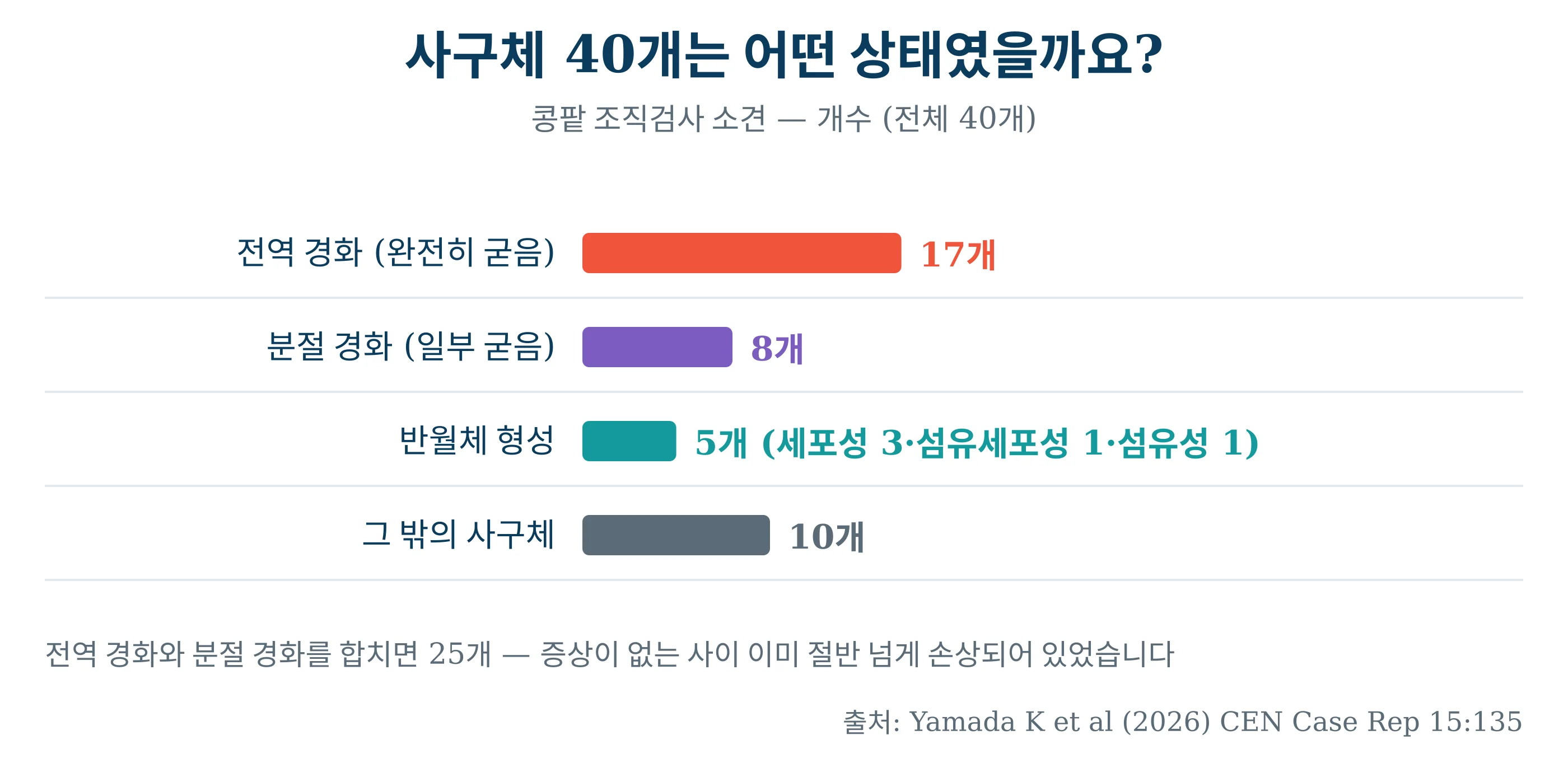 사구체 40개의 상태 — 전역 경화 17개, 분절 경화 8개, 반월체 5개
