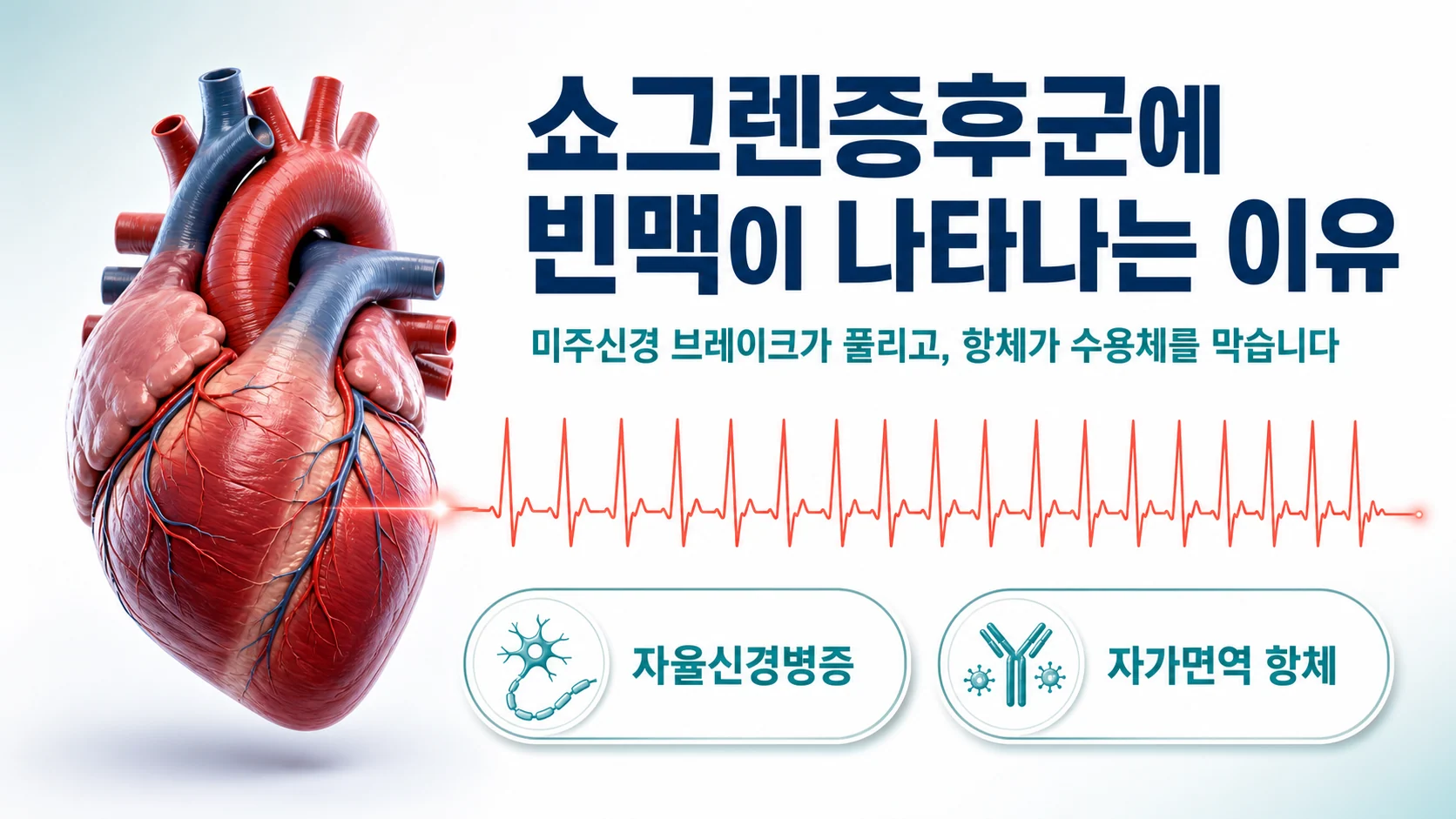 쇼그렌증후군 환자에게 나타나는 빠른 맥박과 그 배경을 설명하는 대표 이미지