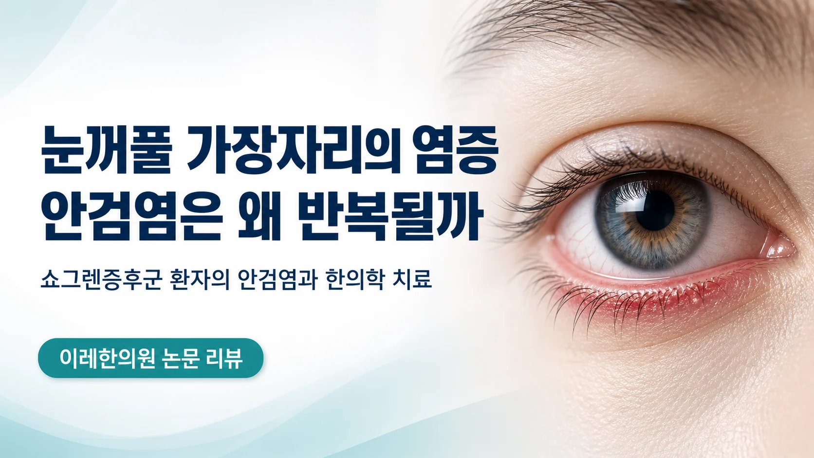 눈꺼풀 가장자리 염증인 안검염을 다루는 글의 표지 이미지