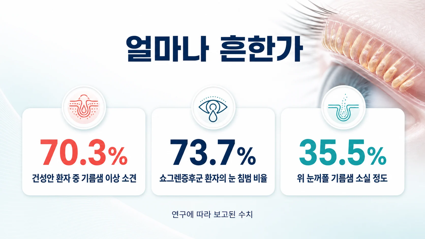 안검염과 기름샘 이상의 유병률 수치를 정리한 통계 이미지