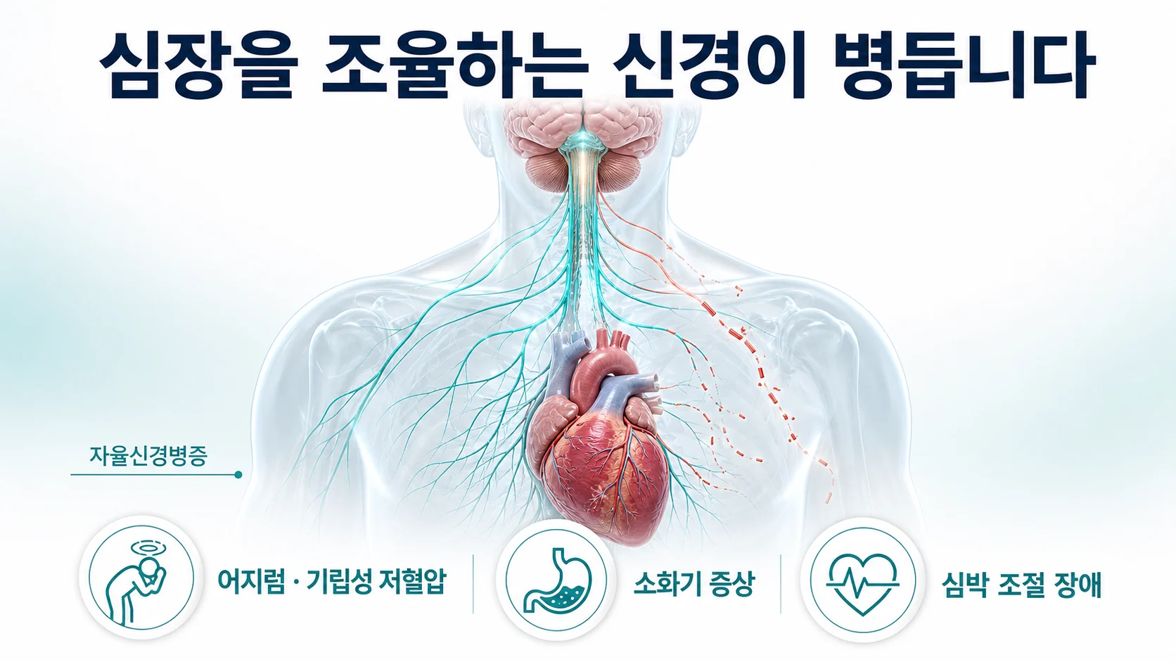 자율신경병증으로 심장을 조율하는 신경 신호가 약해지는 과정을 설명하는 이미지