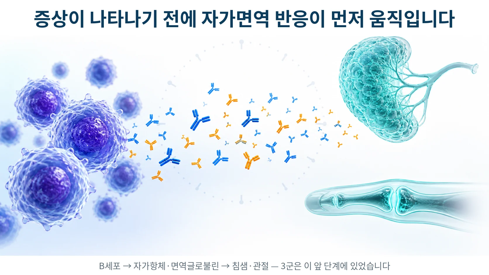 B세포가 자가항체와 면역글로불린을 만들어 내는 자가면역 반응이 증상보다 먼저 진행되는 과정을 표현한 3D 의료 일러스트