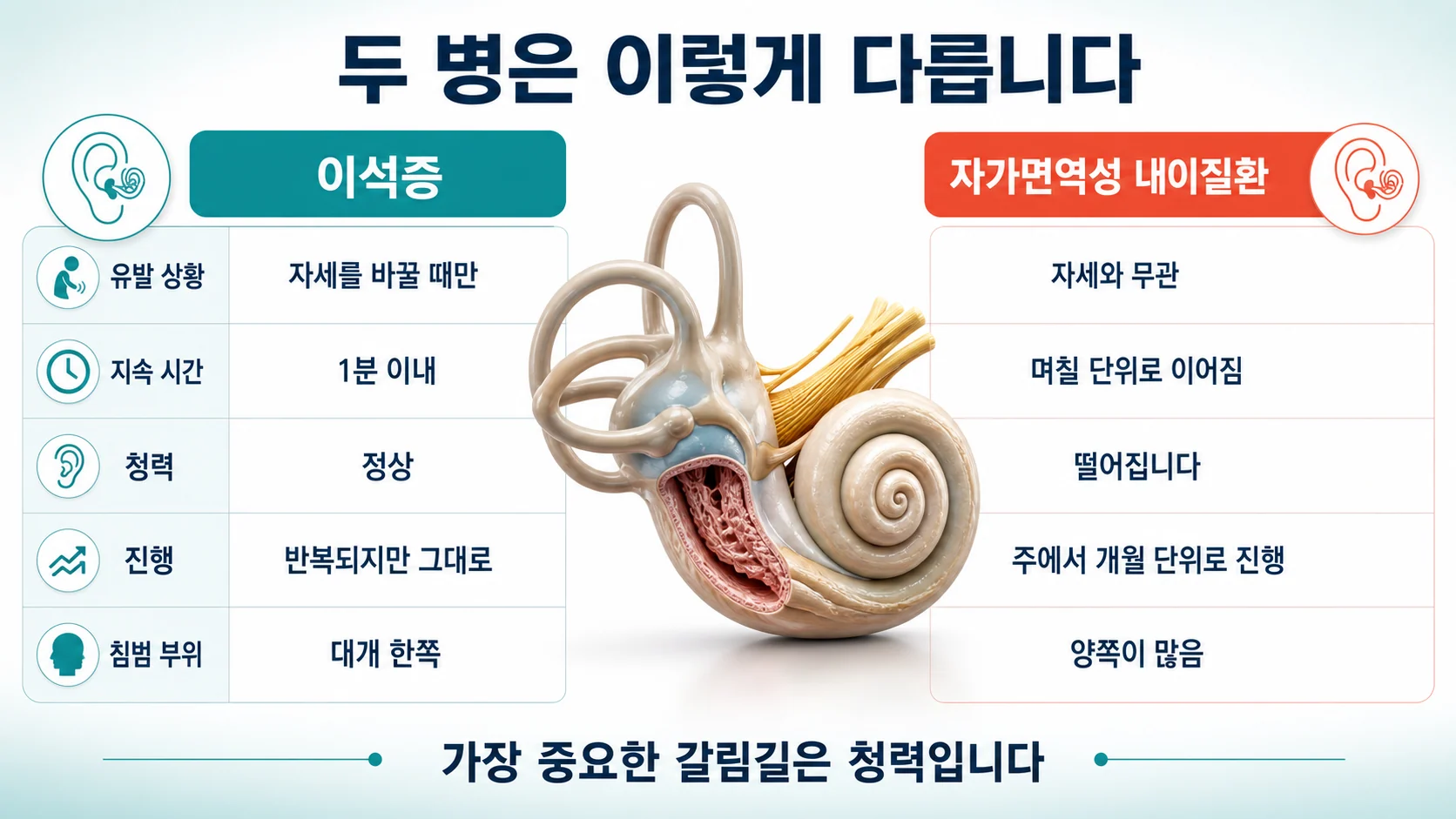 이석증과 자가면역성 내이질환의 차이를 지속 시간과 유발 요인, 청력 동반 여부, 진행 속도로 나누어 좌우로 대비해 보여주는 비교표