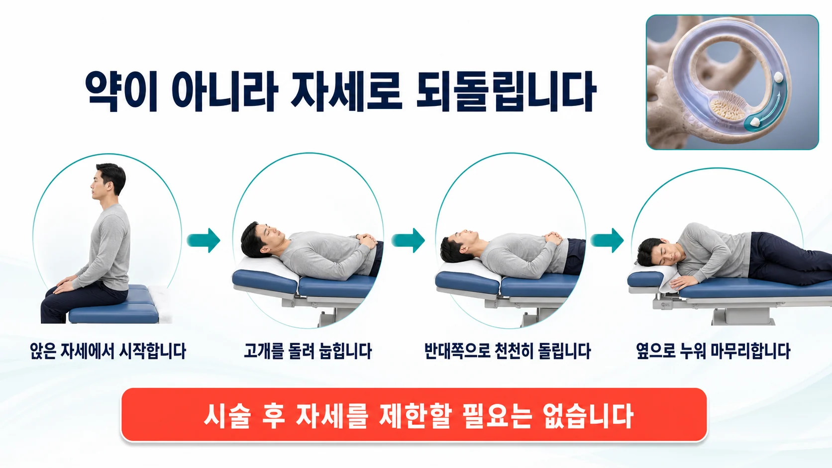 이석 정복술로 반고리관에 들어간 결정을 원래 자리로 되돌리는 과정과 시술 후 자세 제한이 필요하지 않다는 점을 보여주는 그림