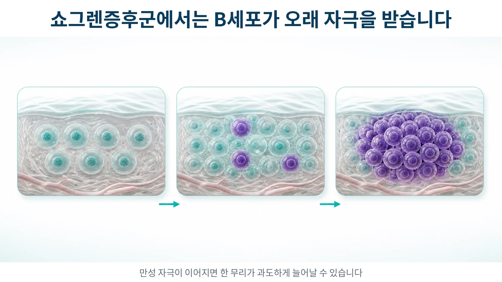 오랜 자극을 받은 B세포 무리 가운데 한 무리만 유난히 많이 늘어난 모습을 단계적으로 보여 주는 그림