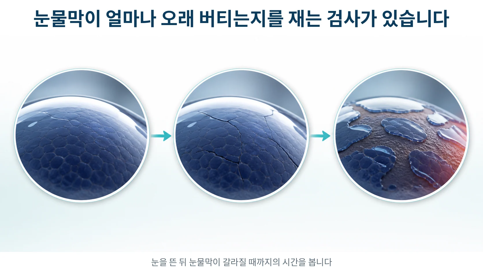 눈을 뜬 직후 매끈하던 눈물막이 시간이 지나며 갈라지고 마른 자국이 생기는 과정을 세 단계로 보여 주는 그림