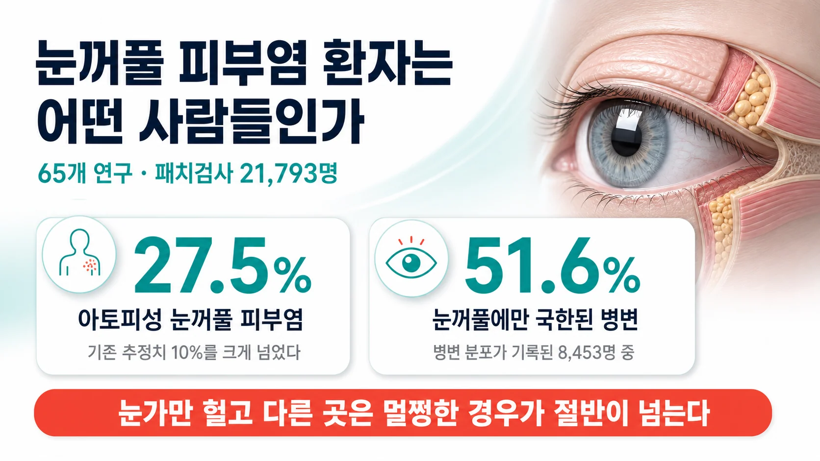 눈꺼풀 피부염 환자군의 구성