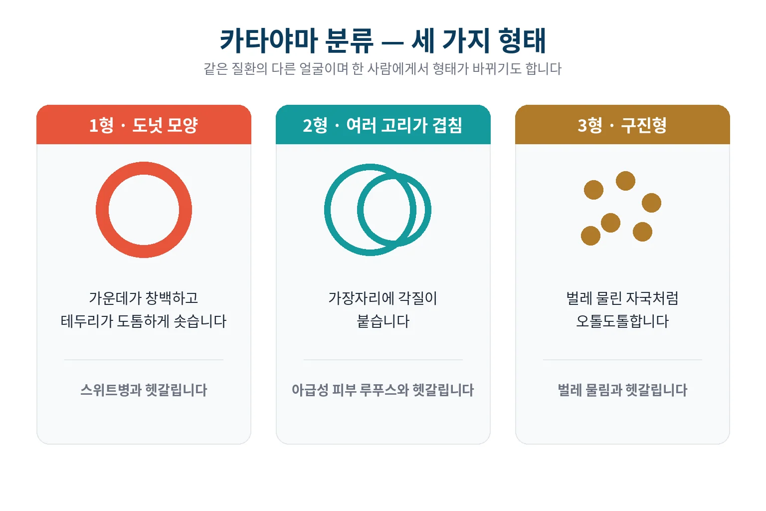 카타야마 분류 세 가지 형태