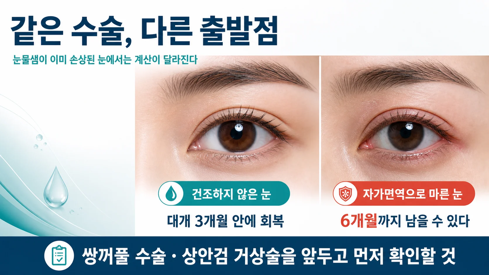 쇼그렌증후군 환자가 눈 주변 성형수술을 고려할 때 달라지는 출발점