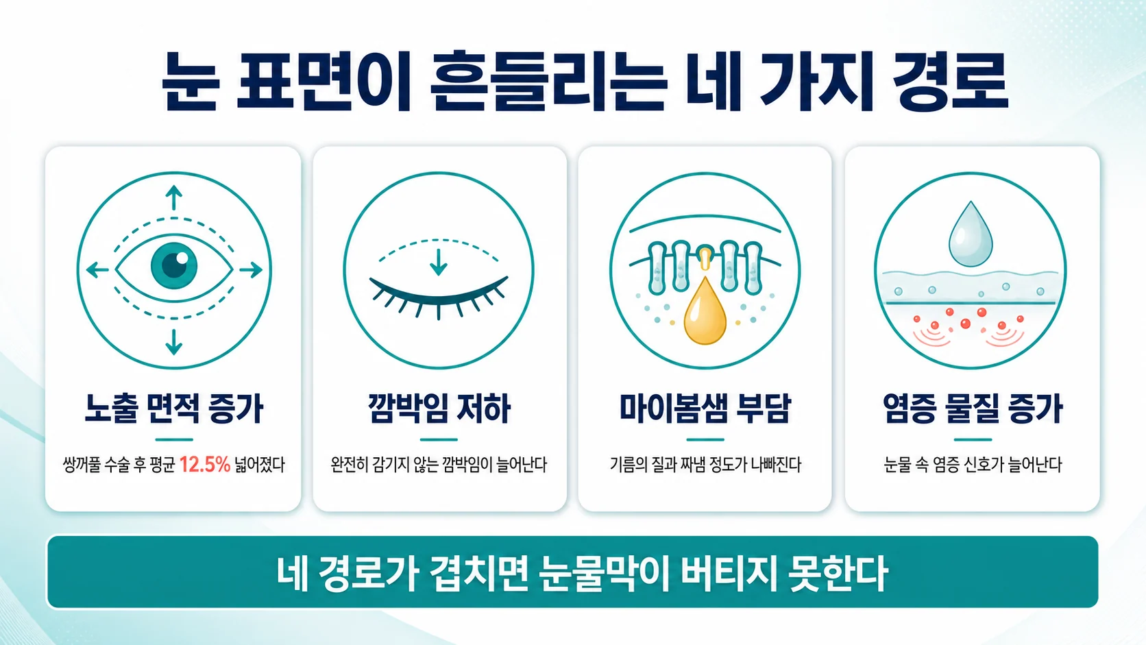 눈 주변 성형이 눈 표면을 흔드는 네 가지 경로
