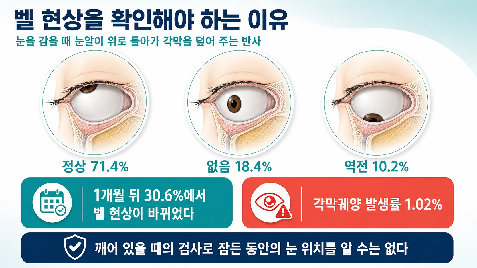 벨 현상과 각막 합병증 위험