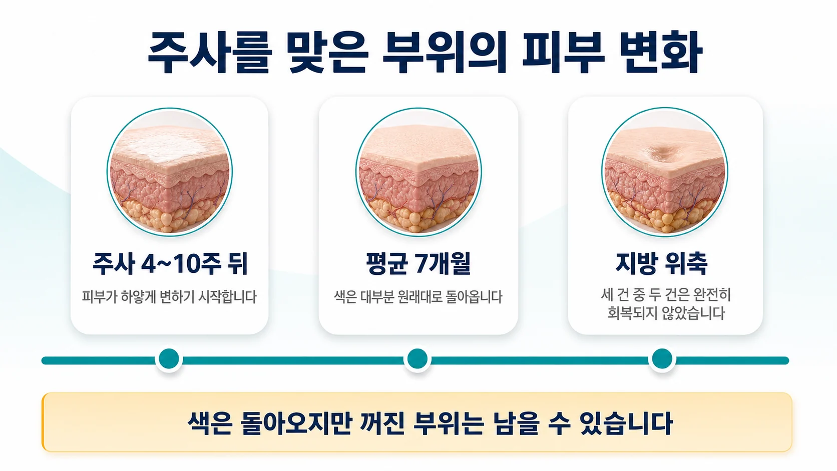 주사 맞은 부위의 피부와 지방에 생기는 변화의 시간표