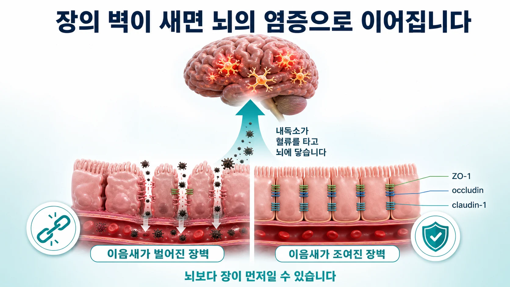 장내 세균의 균형이 무너지면 장벽이 새고 내독소가 혈류로 들어가 뇌의 염증으로 이어지는 과정과 한약이 장벽 단백을 회복시키는 지점을 보여주는 그림