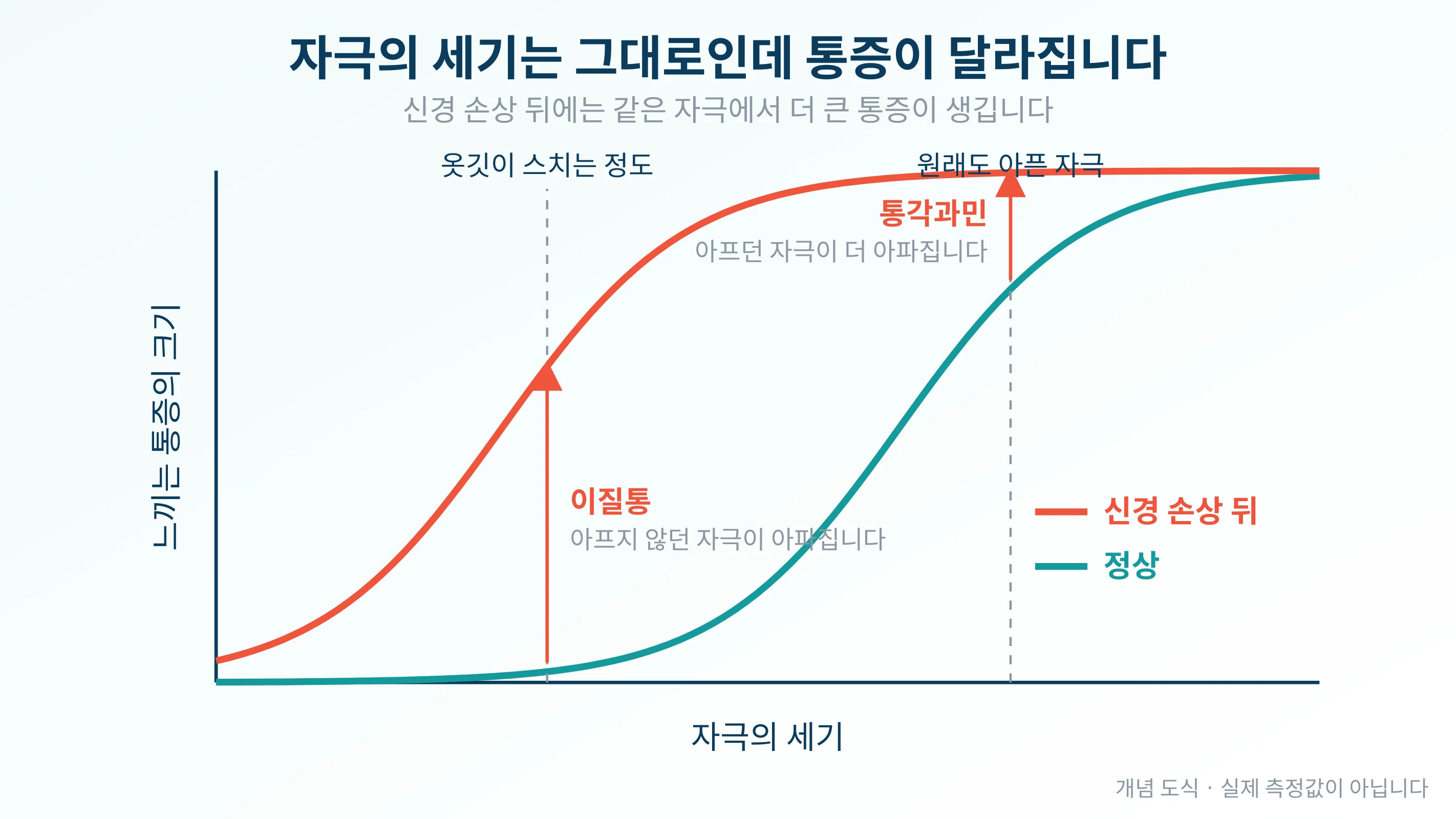 자극의 세기는 같은데 통증 반응 곡선이 왼쪽으로 이동해 이질통과 통각과민이 생기는 과정을 나타낸 그래프
