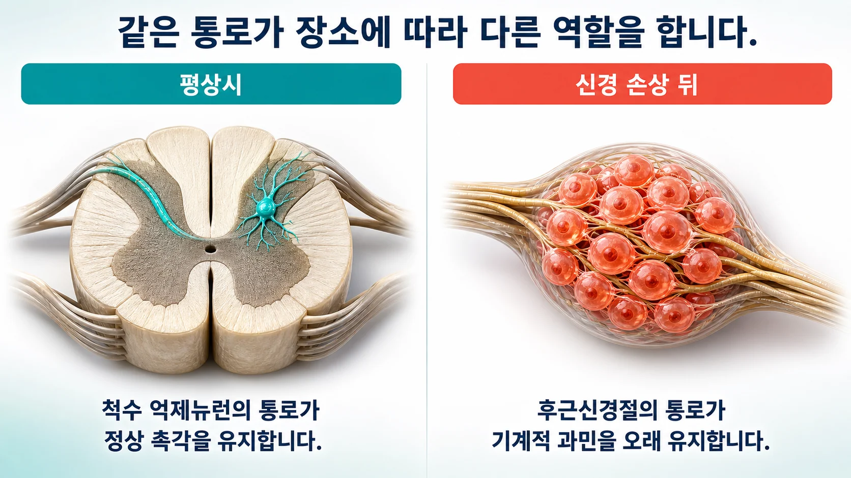 척수 억제뉴런의 TWIK-1은 평상시 촉각을, 후근신경절의 TWIK-1은 손상 후 과민의 지속을 담당한다는 두 갈래 도식