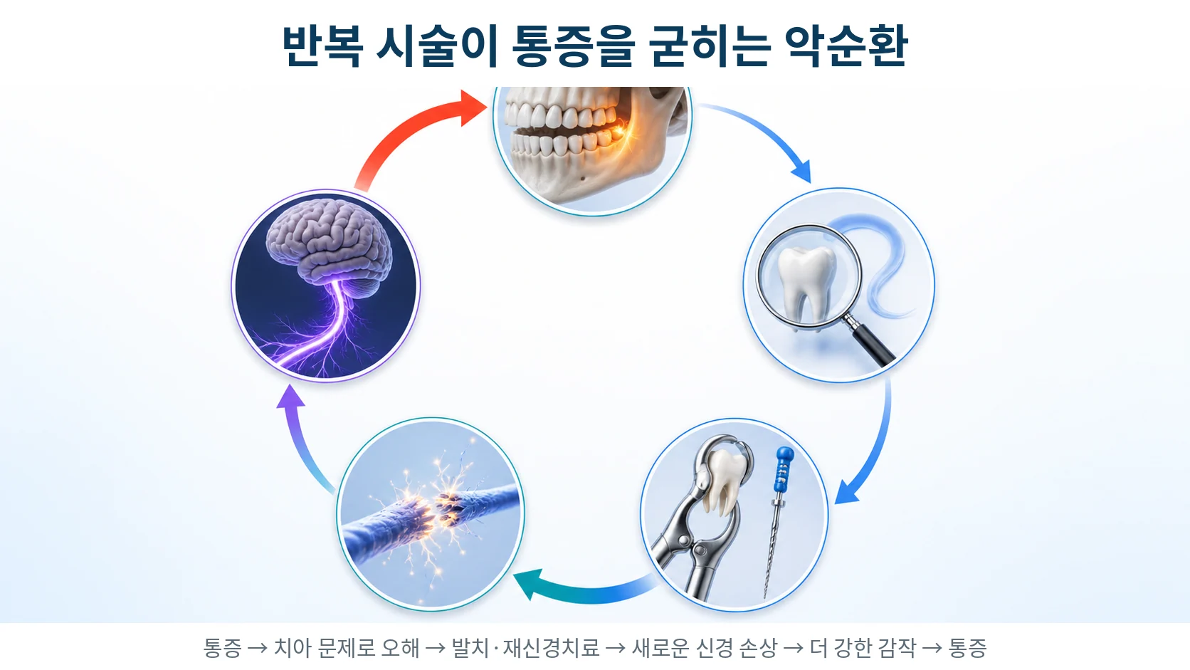 불필요한 발치와 재신경치료가 반복될수록 삼차신경 감작이 굳어지는 악순환을 표현한 도식