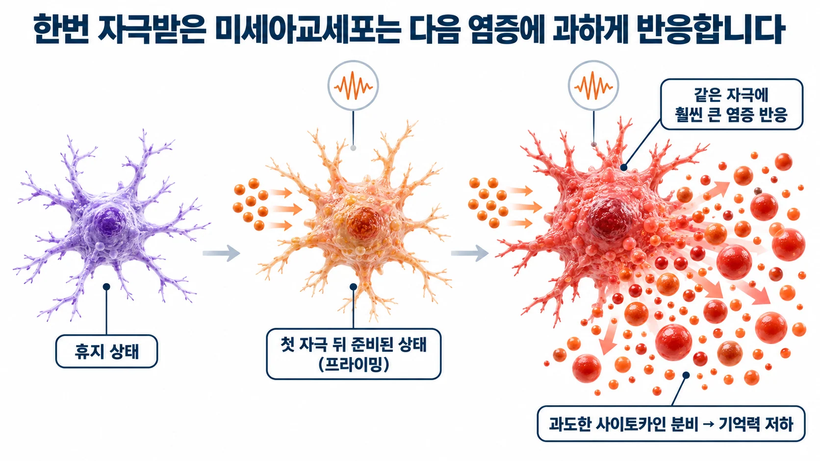 휴지 상태의 미세아교세포가 첫 자극 뒤 프라이밍되고, 같은 크기의 두 번째 자극에 훨씬 큰 염증 반응을 보이는 과정