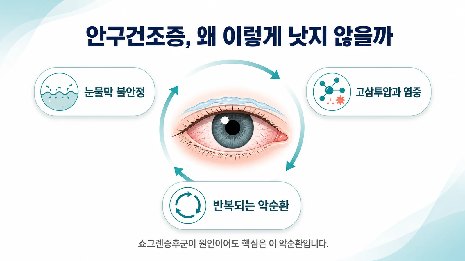 안구건조증, 왜 이렇게 낫지 않을까