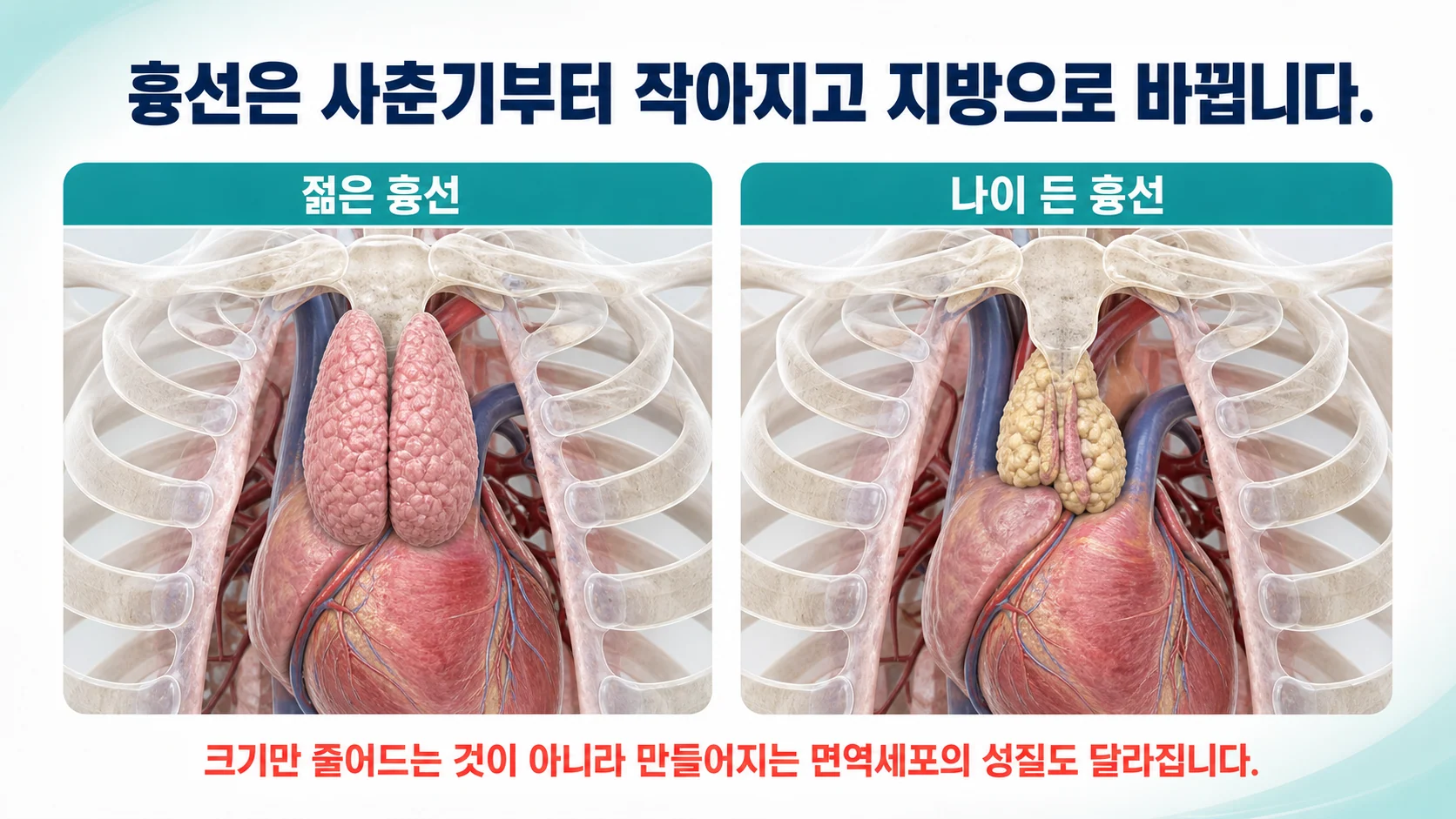 가슴뼈 뒤에 자리한 흉선이 나이가 들면서 작아지고 지방으로 바뀌는 과정을 보여주는 단면 그림