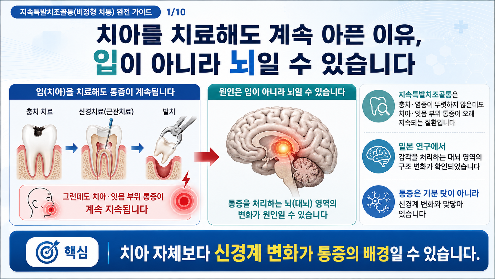 지속특발치조골통(비정형 치통) 핵심 — 치아 자체보다 신경계 변화가 통증의 배경일 수 있다