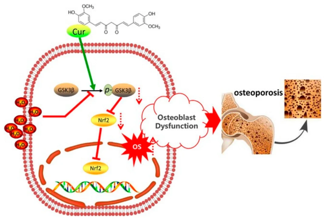 커큐민이 GSK3β–Nrf2 신호를 보존해 산화스트레스성 조골세포 기능장애를 막는 기전