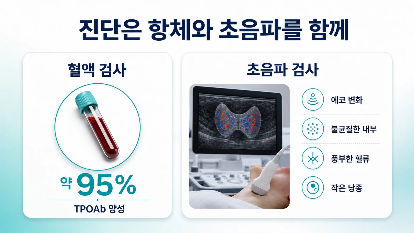 진단 검사를 설명하는 인포그래픽. 갑상선과산화효소항체 TPOAb 약 95퍼센트 양성과 초음파 소견인 에코 변화, 불균질, 풍부한 혈류, 작은 낭종