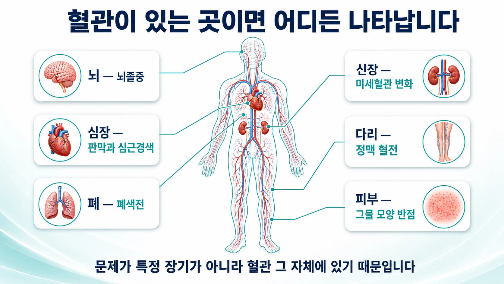 이 병은 어느 장기든 침범할 수 있습니다