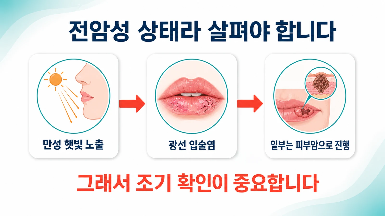 만성 햇빛 노출에서 광선 입술염을 거쳐 일부가 피부암으로 진행하는 흐름