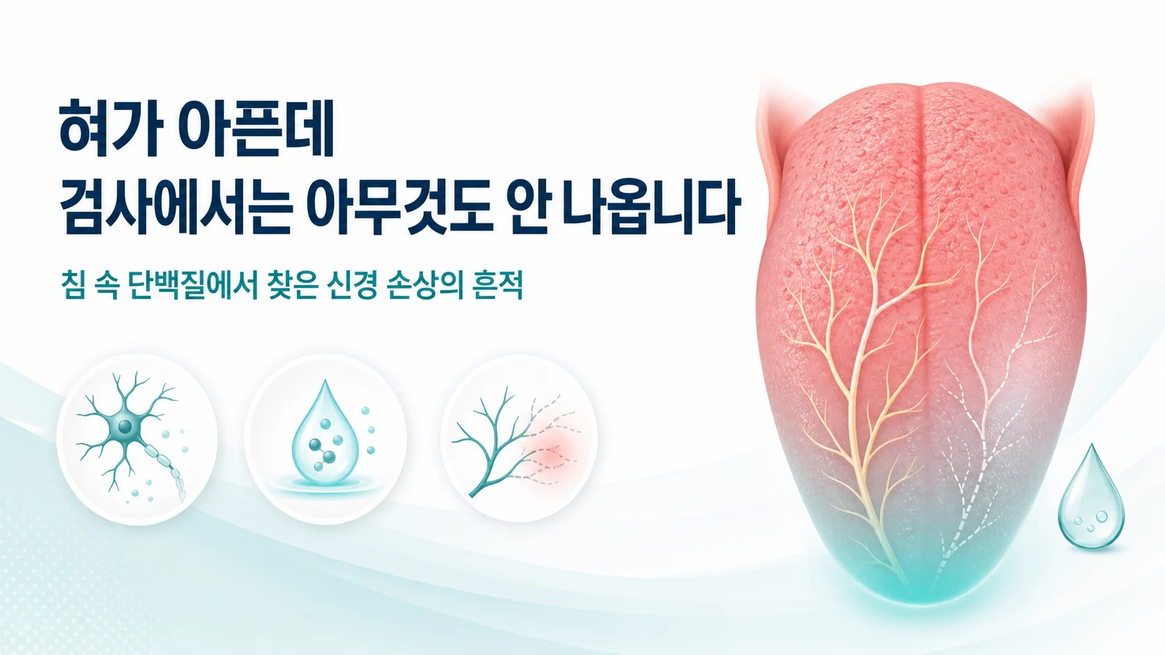 혀가 아픈데 검사에서는 아무것도 안 나옵니다라는 문구와 혀끝의 가는 신경을 그린 안내 이미지