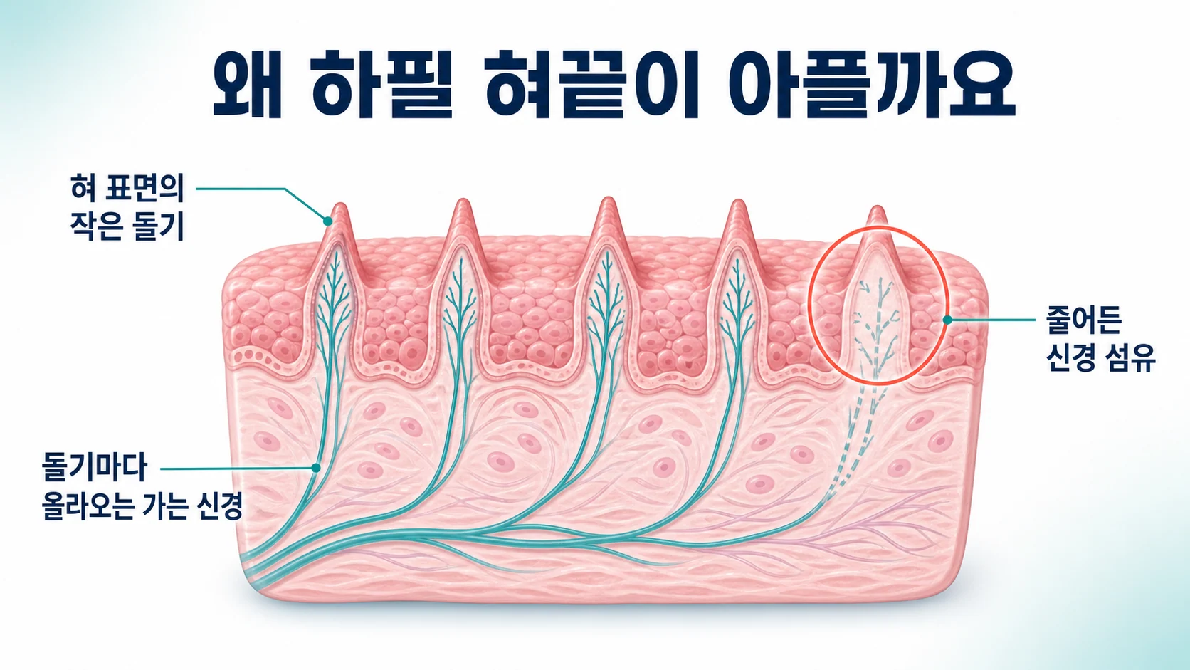 혀 표면의 작은 돌기와 그 안으로 올라오는 가는 신경, 줄어든 신경 섬유를 그린 이미지