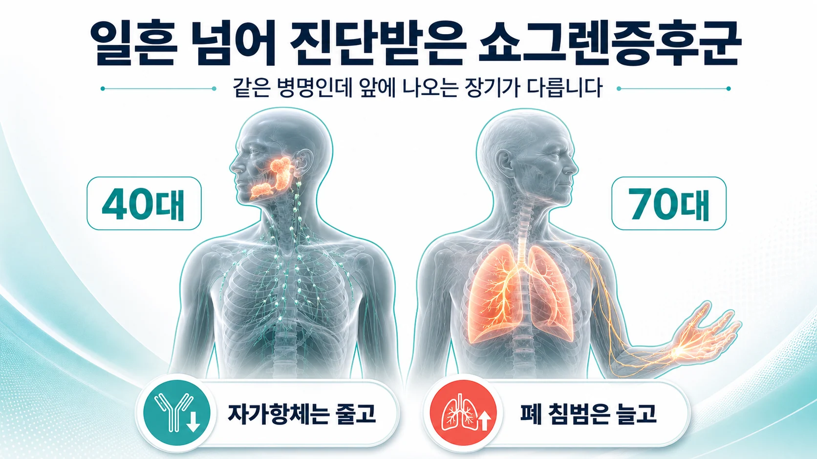 70세 이후에 쇼그렌증후군 진단을 받았을 때 나타나는 특징을 설명하는 대표 이미지