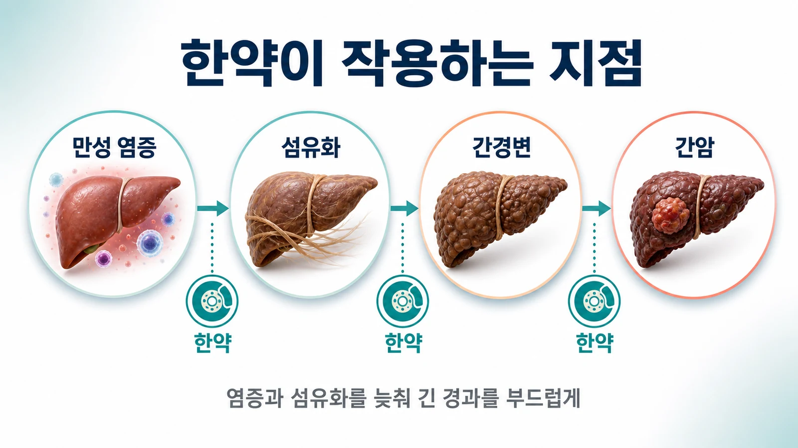 만성 염증에서 섬유화, 간경변, 간암으로 이어지는 경로에 한약이 작용하는 지점을 표현한 이미지
