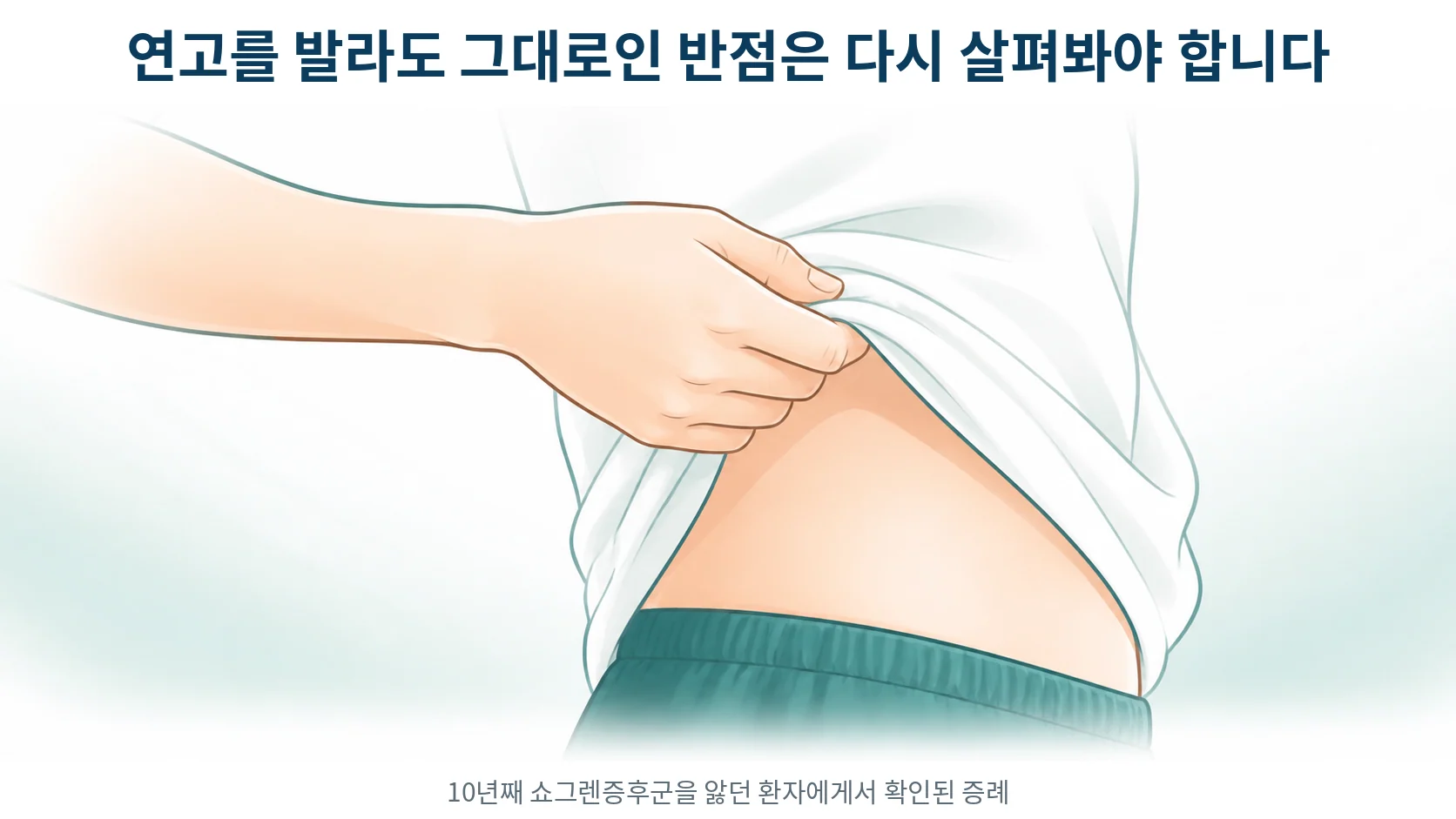 쇼그렌증후군, 몸통에 붉은 반점이 생겨 연고를 발라도 그대로일 때