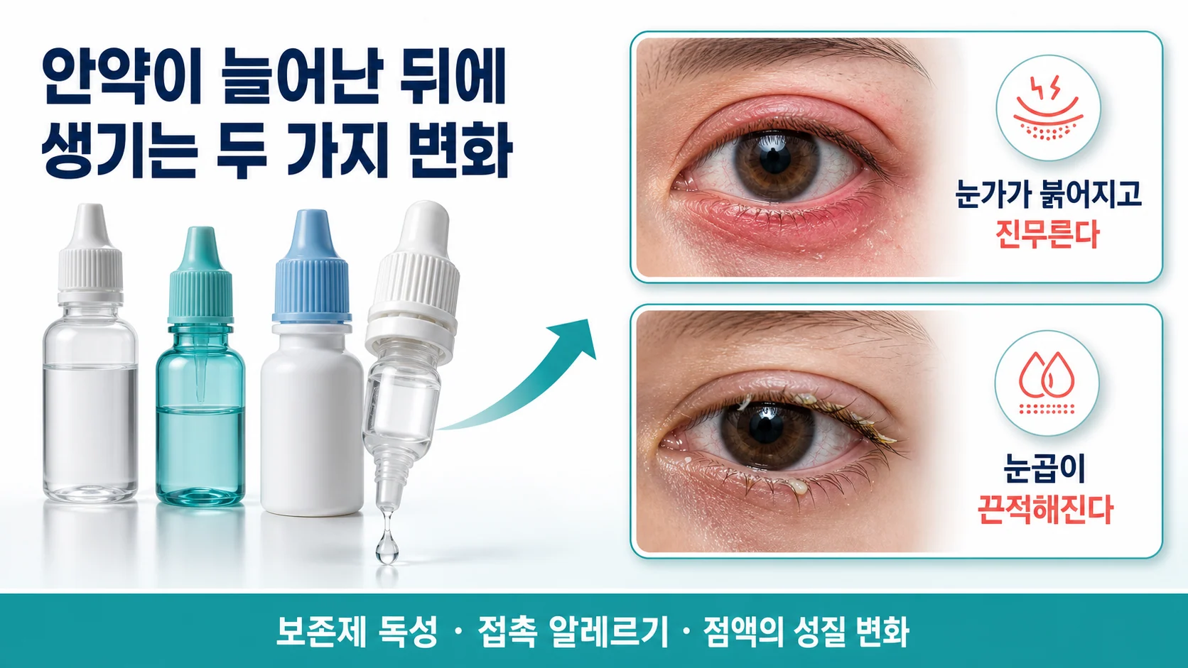 쇼그렌증후군 안약을 여러 개 쓸 때 눈가가 진무르고 눈곱이 끈적해지는 이유