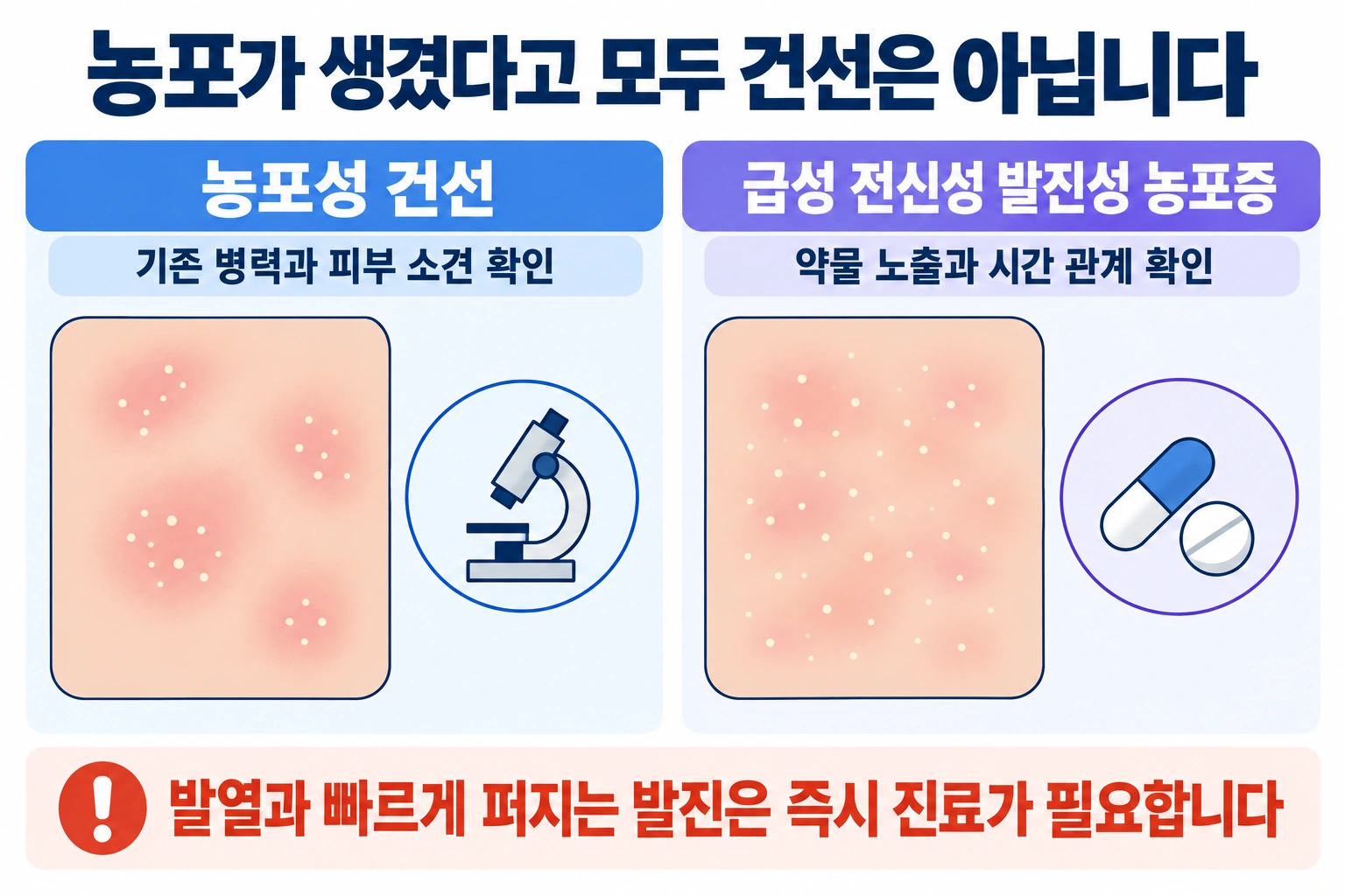 농포성 피부질환과 급성 약물 반응은 모양만으로 구분하기 어렵다는 점을 부드러운 의학 일러스트로 표현한 그림