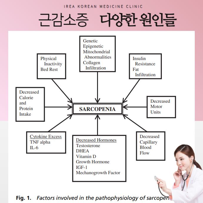 자가면역질환과 근감소증 원인