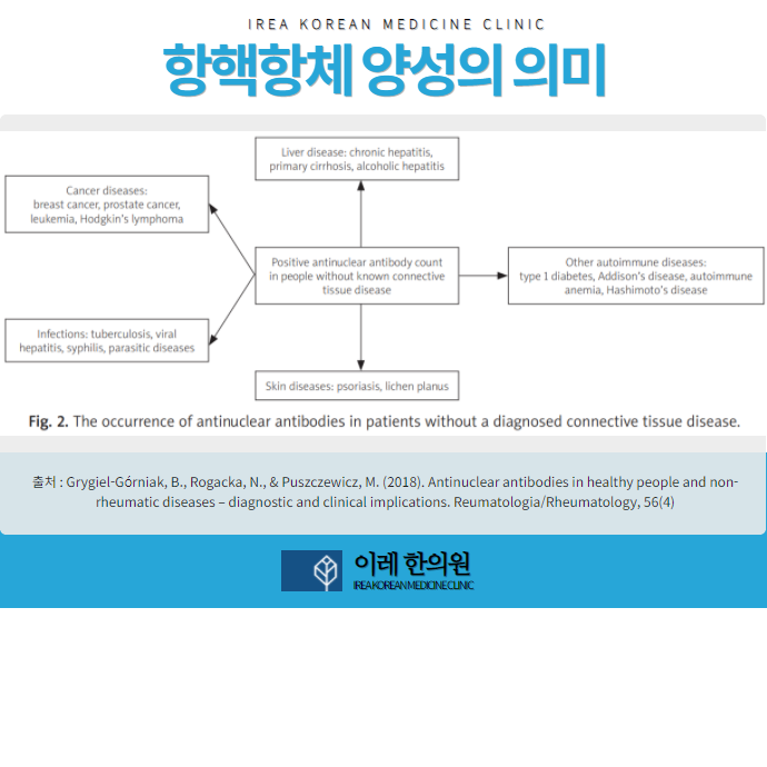 항핵항체 양성 원인