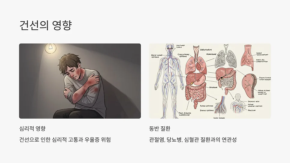 건선은 쇼그렌증후군 진단 위험을 높이는 자가면역질환입니 #11