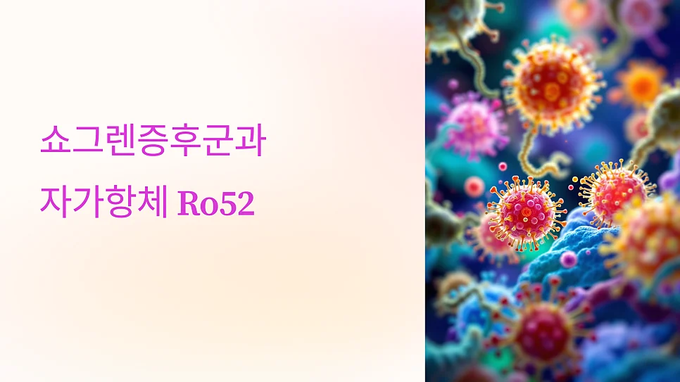 쇼그렌증후군 검사에서 anti-Ro52만 양성인 경우, 어떤 특징이 있을까요?