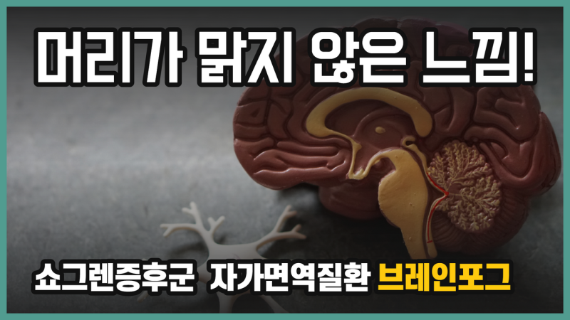 쇼그렌증후군 브레인 포그: 머리가 맑지 않은 이유와 대처법