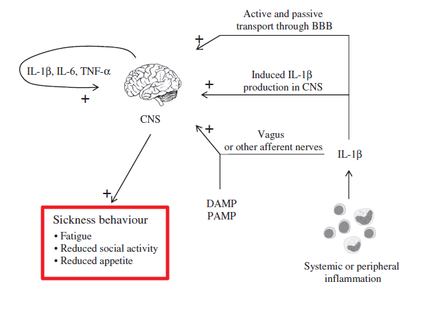 쇼그렌증후군 환자의 피로감(fatigue)